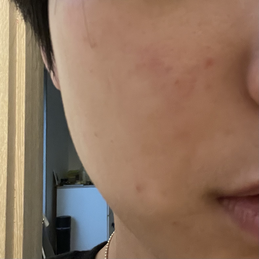 에드뷰 (EDVIEW) 발효 영양크림 review image