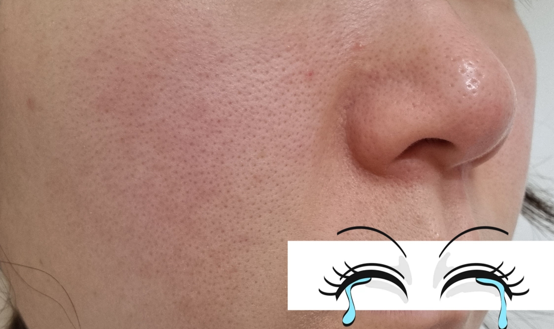 Real user review photo of Nutrition Skin Essence