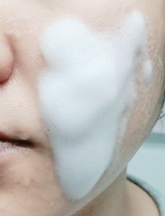 세바메드 (sebamed) 클리어페이스 안티박테리얼 클렌징폼 review image