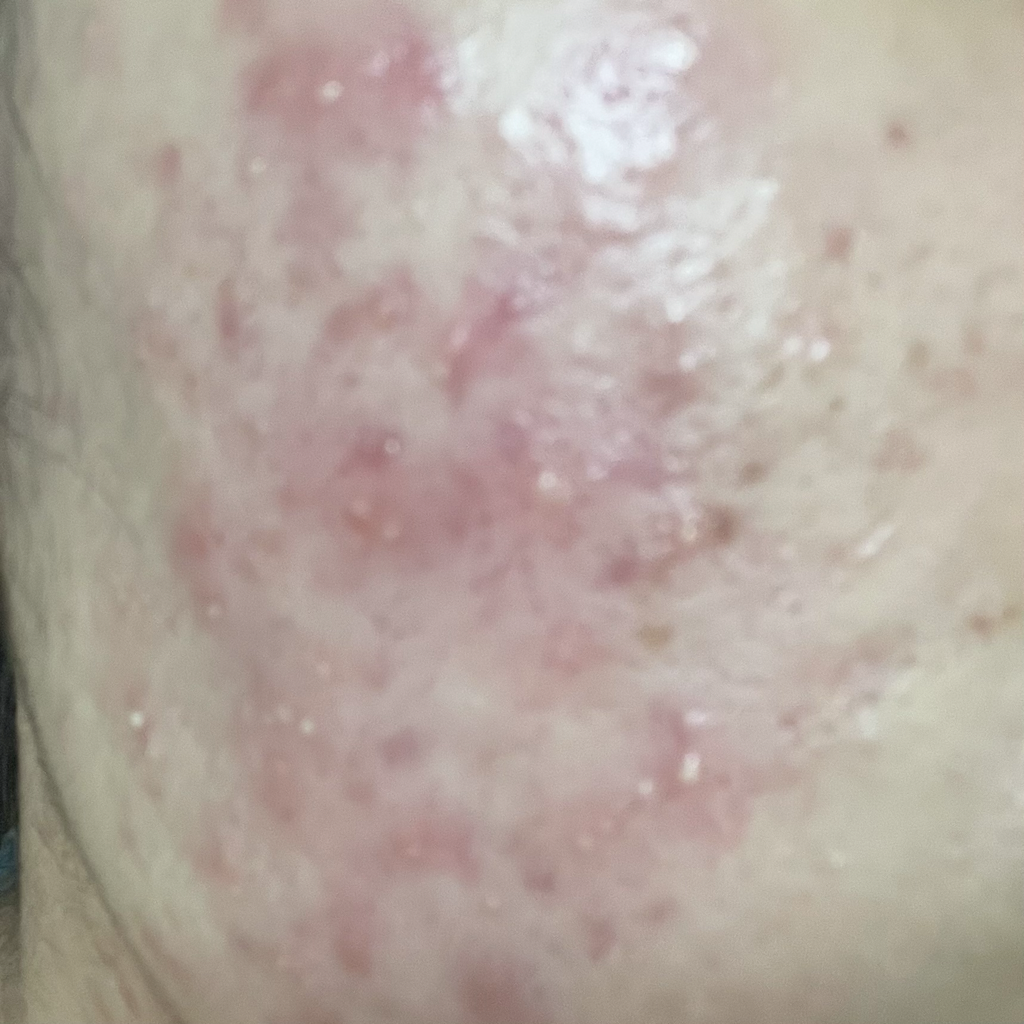 零毛孔洁面乳[适合油性肌肤]的真实用户使用照片