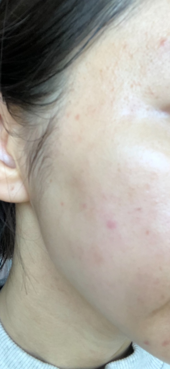 马力 阿苏琳保湿舒缓垫 common.review image