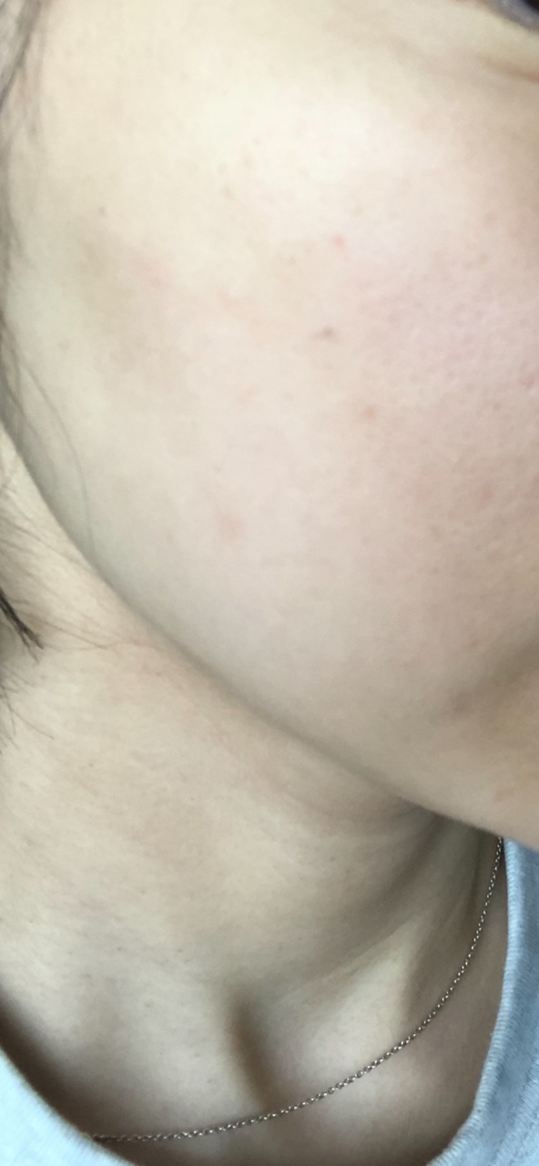 马力 阿苏琳保湿舒缓垫 common.review image