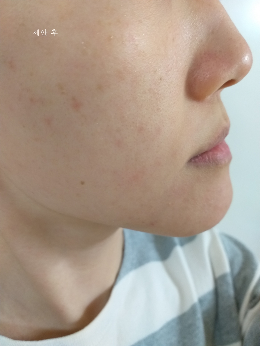 Real user review photo of EGF+hGH Revital Ampoule