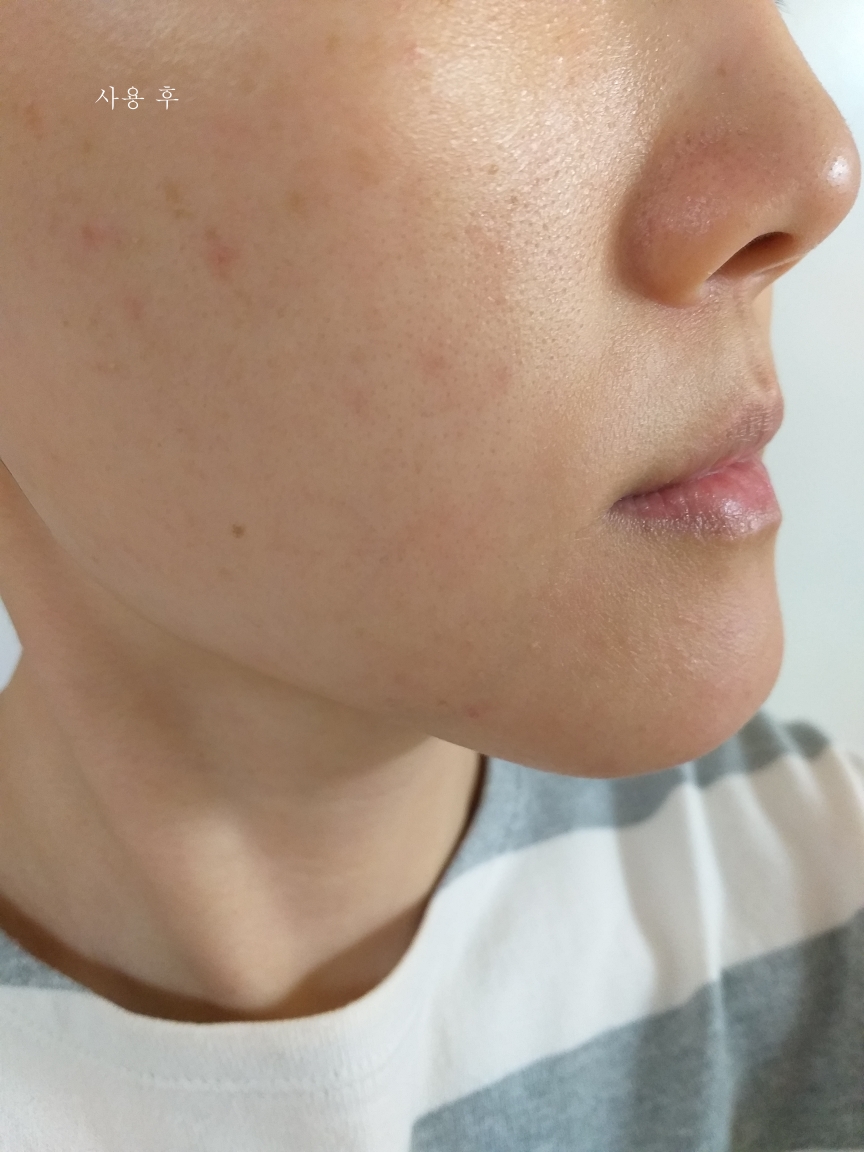 Real user review photo of EGF+hGH Revital Ampoule