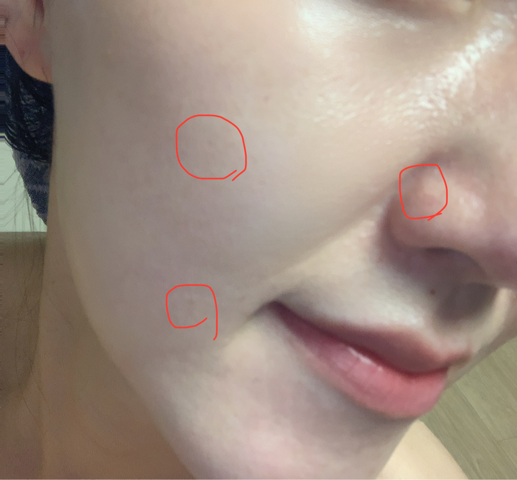 에드뷰 (EDVIEW) 딥 뉴트리 펩타이드 앰플 review image