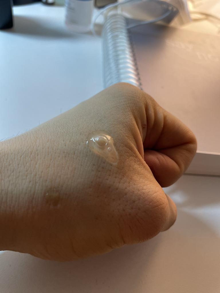 比菲达生物群精华的真实用户使用照片