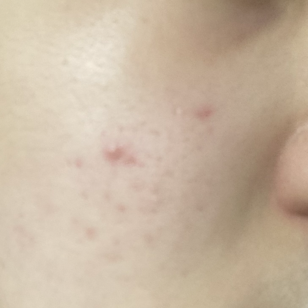 3pages (쓰리페이지) 오버나이트 트리트먼트 펩타이드 세럼 review image