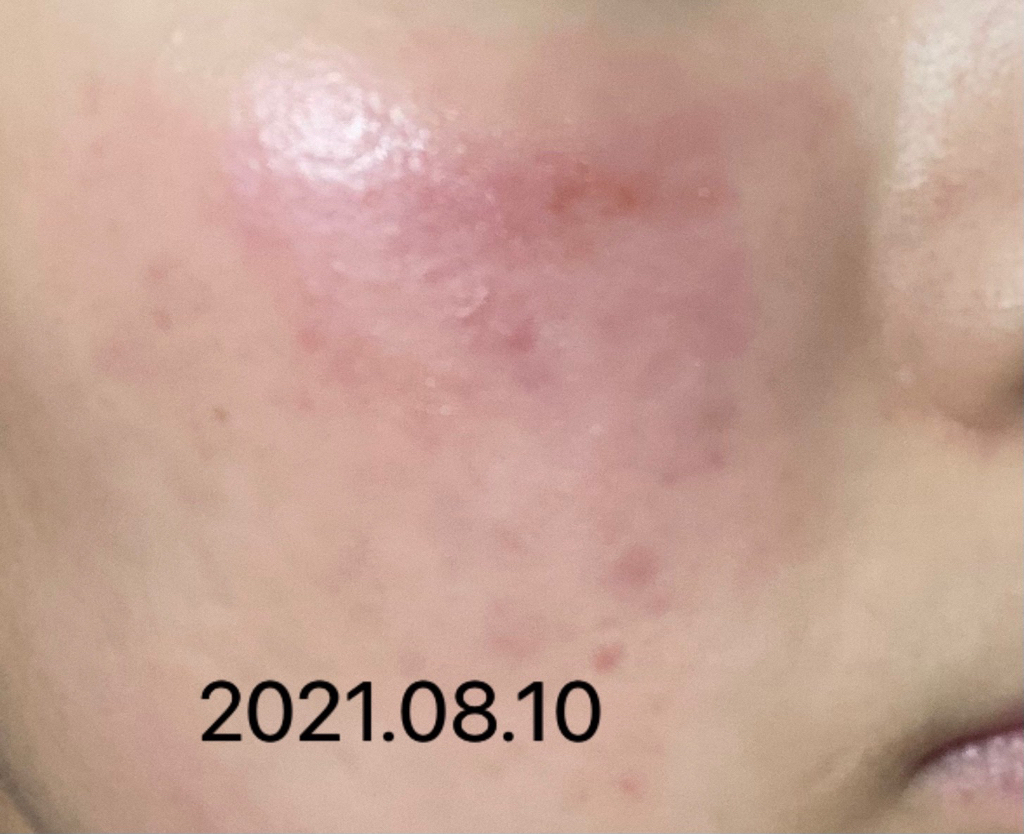 100% Mayu的真实用户使用照片