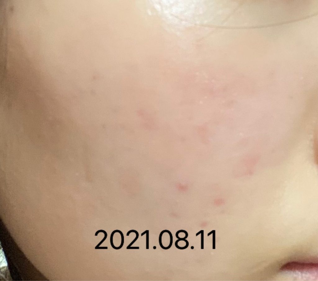 100% Mayu的真实用户使用照片