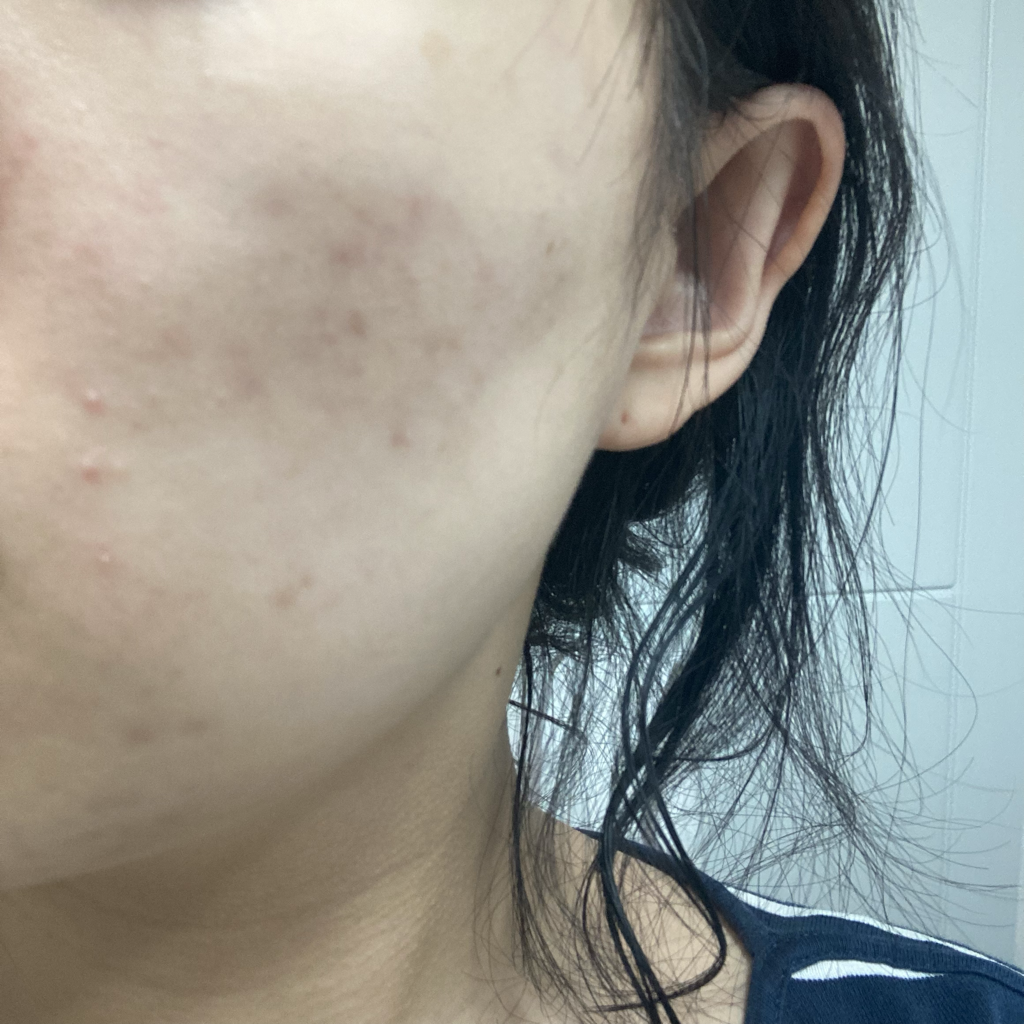 鲨烷修护面霜的真实用户使用照片