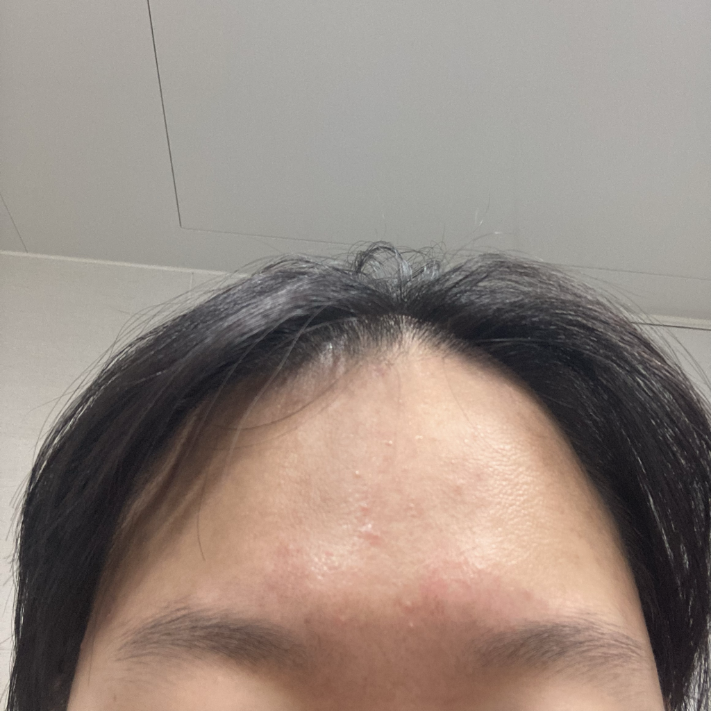 鲨烷修护面霜的真实用户使用照片