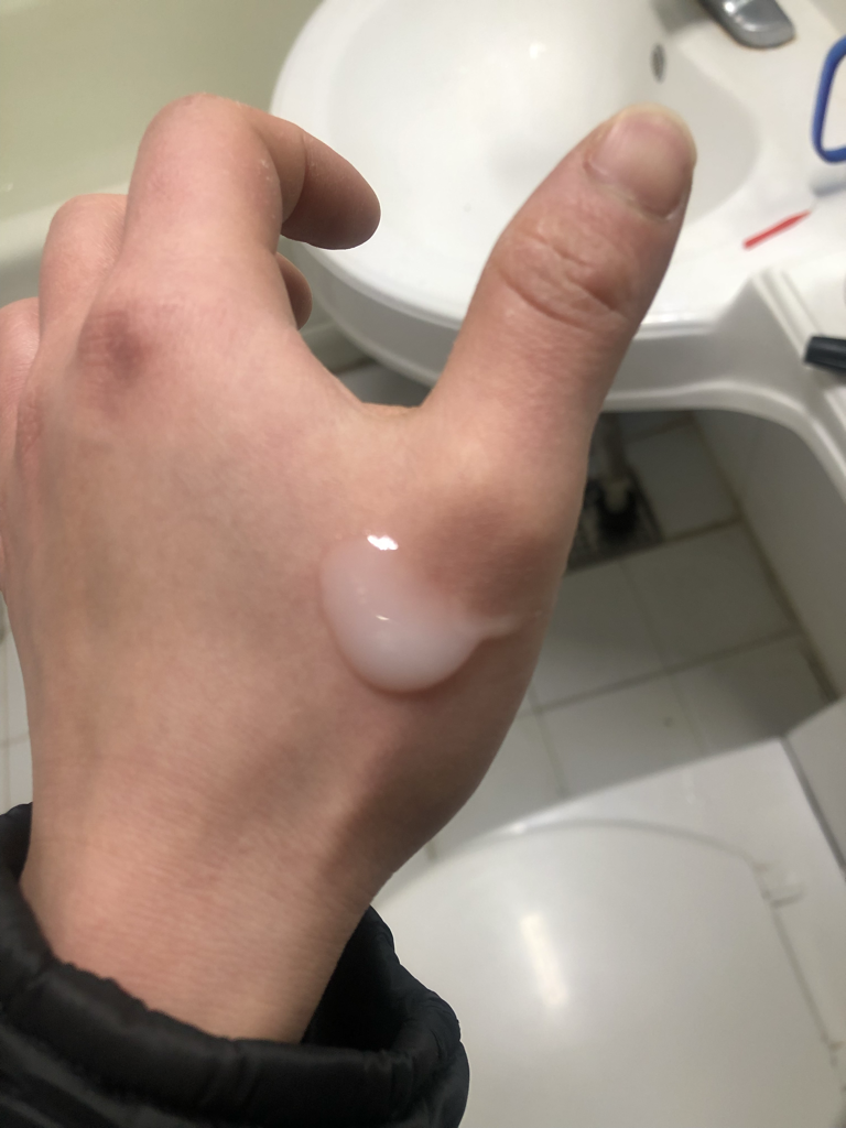 西卡胶原蛋白镇静精华的真实用户使用照片