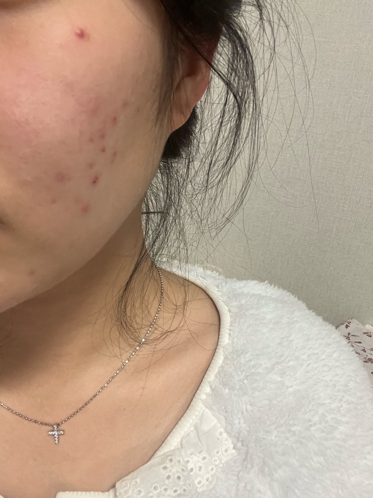 西卡胶原蛋白补水爽肤水的真实用户使用照片