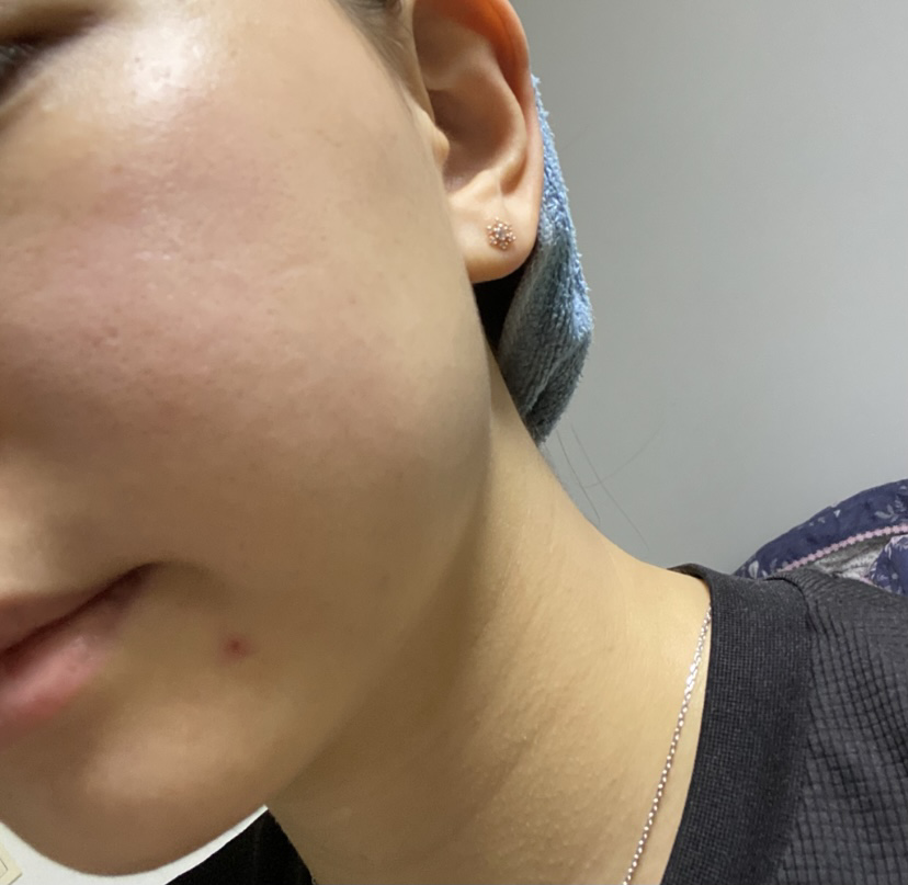 더마픽스 (DERMAFiX) 시카콜라겐 카밍 세럼 review image