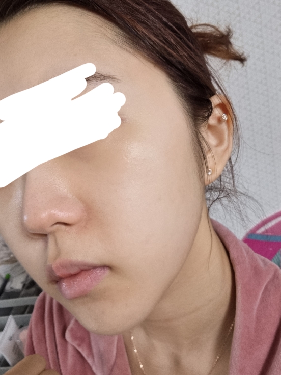 닥터하스킨 (Dr.HASKIN) 미라클아토 하이드로 에멀전 review image