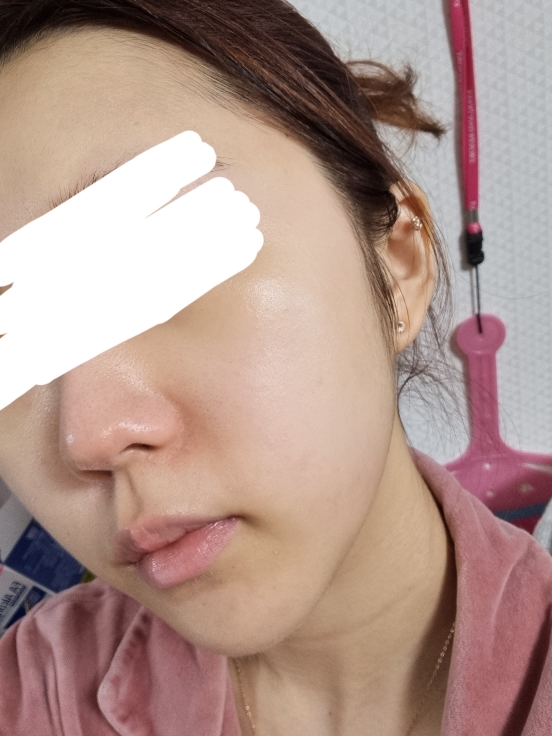 닥터하스킨 (Dr.HASKIN) 미라클아토 하이드로 에멀전 review image