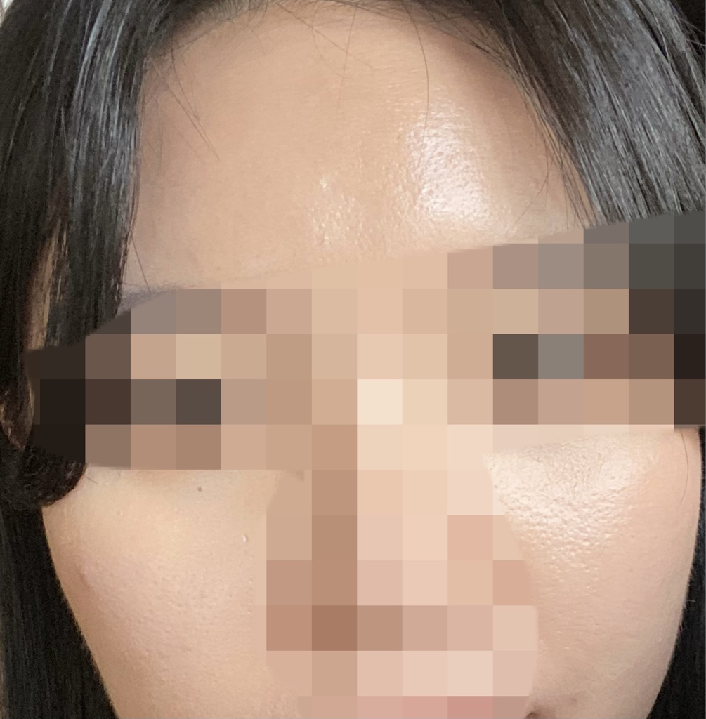 더뮤트 (themu:te) 돌리도 티트리 겔 review image
