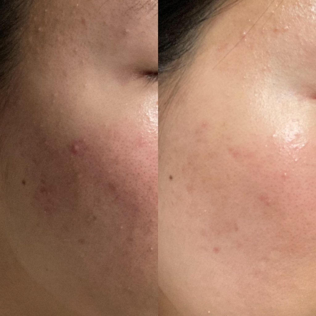 SKINEYE AC 纯净芦荟修复霜 common.review image