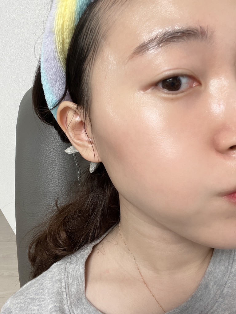 DAC2 阿拉斯加 LMW 玻尿酸爽肤水的真实用户使用照片
