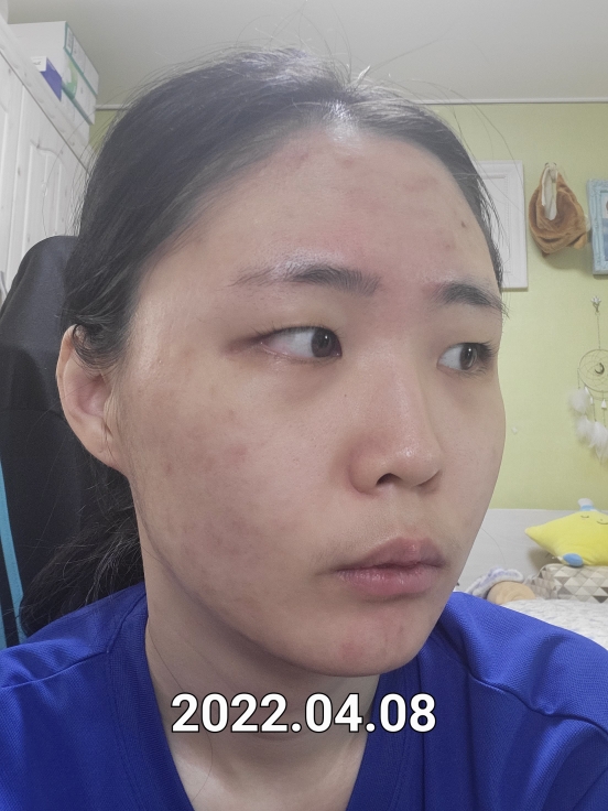 雪白纯净光采安瓶的真实用户使用照片
