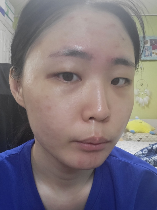 雪白纯净光采安瓶的真实用户使用照片