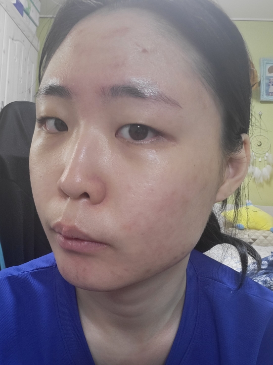 雪白纯净光采安瓶的真实用户使用照片