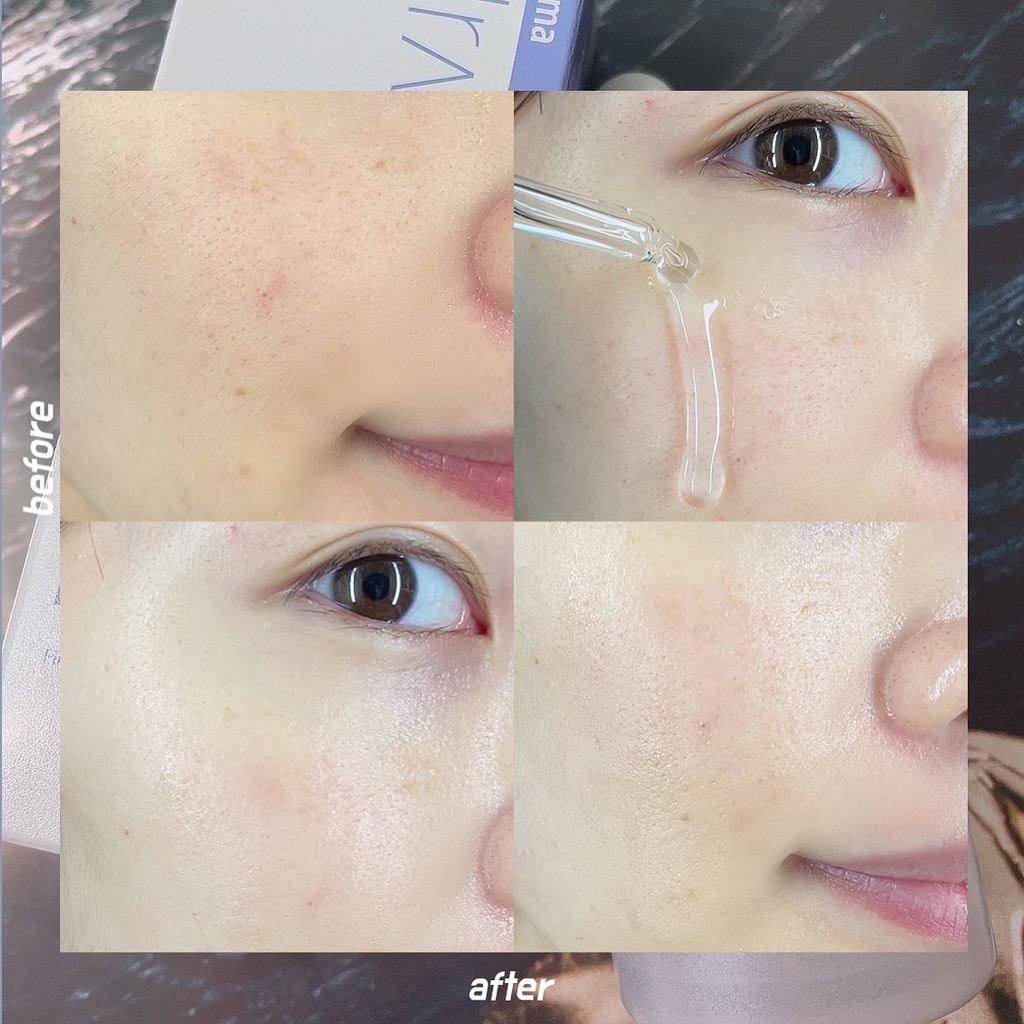 엘라비에코스메틱 (elraviecosmetic) 보탈리늄 타임리스 텐션 앰플 review image