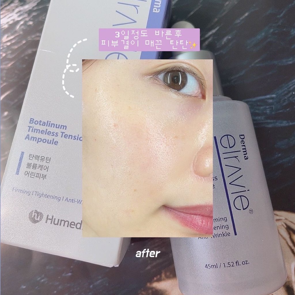 엘라비에코스메틱 (elraviecosmetic) 보탈리늄 타임리스 텐션 앰플 review image