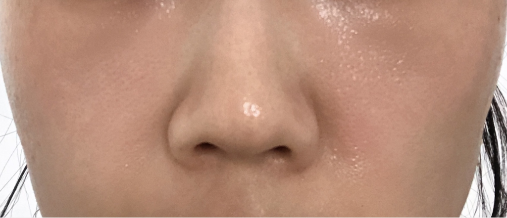 휘게 (HYGGEE) 릴리프 블루 플라워 마스크 review image