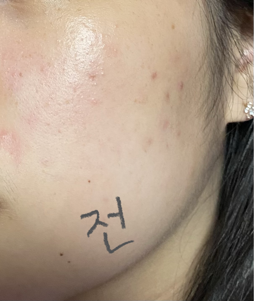 프리업 (Freeup) 피스풀 스킨 수딩 패드 review image