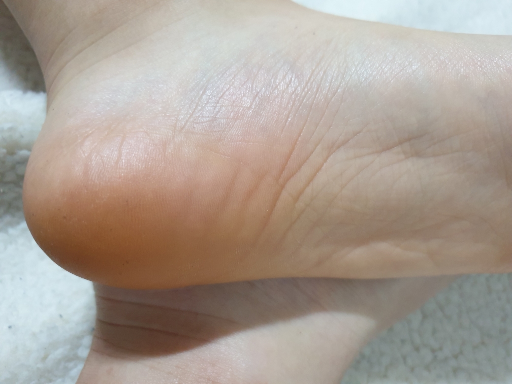 Himalaya foot care cream review image