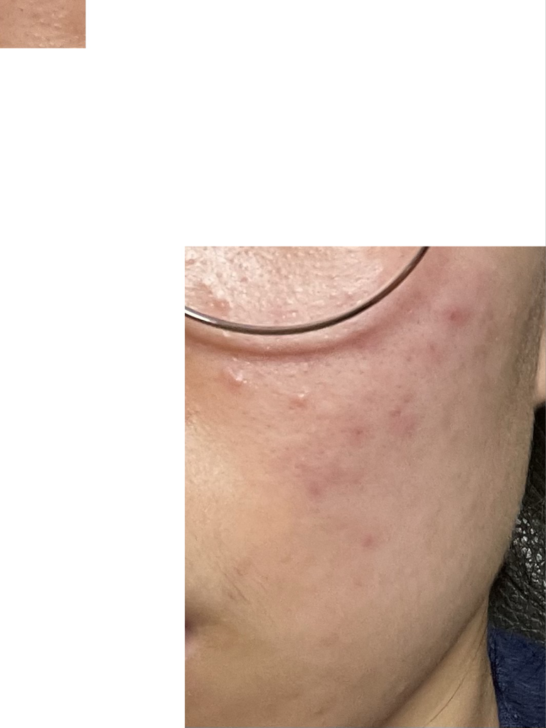 Real user review photo of Tea Tree Care Solution Essential Mask EX