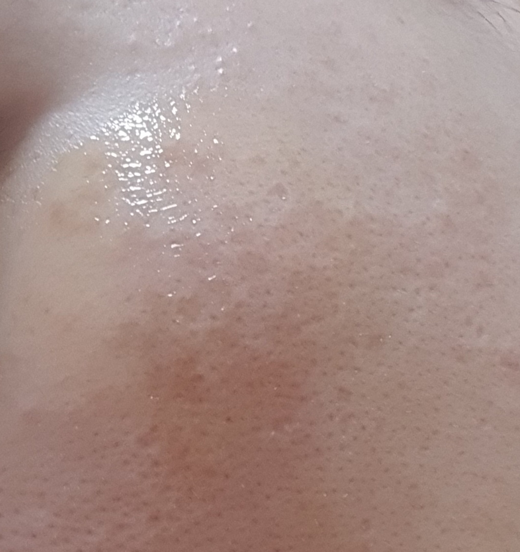 셀비엔 (CELLBN) 블래미쉬 패치 review image
