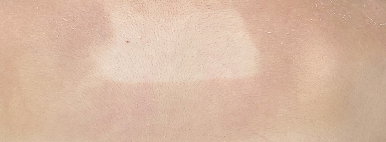 AHC Natural Perfection Pro Shield Sun Stick [SPF50+/PA++++] review image