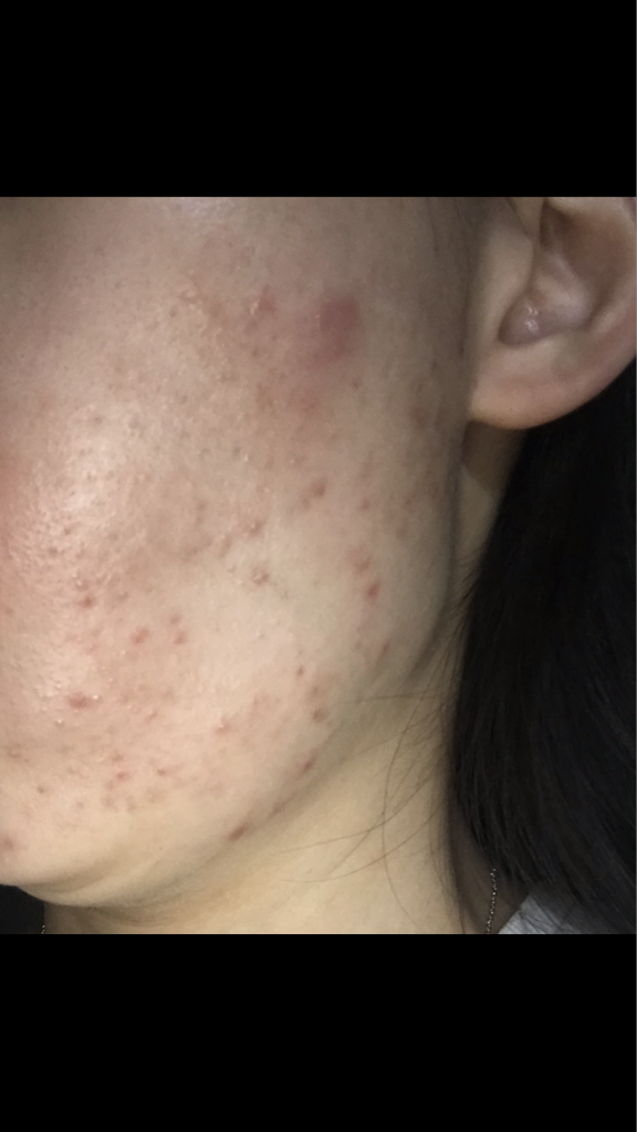 舒缓洁面乳的真实用户使用照片