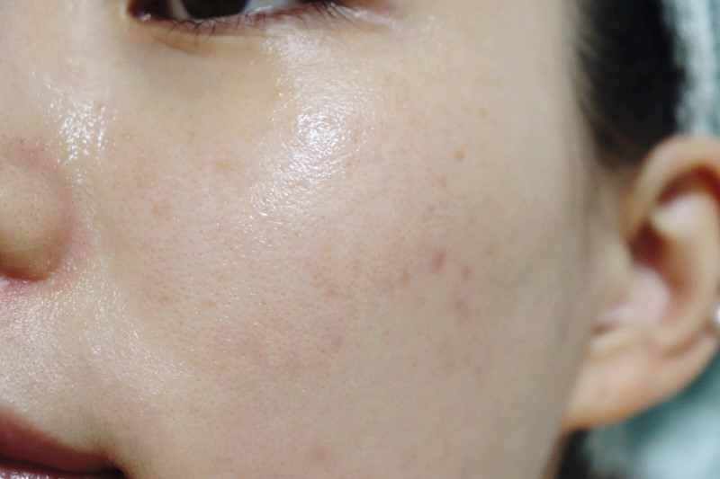뷰앤뷰 (BEAUNBEAU) 리페어 인텐시브 에센스 review image