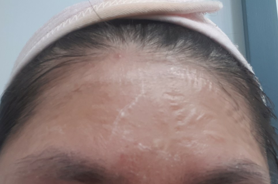 좀비뷰티 (ZOMBIEBEAUTY) 좀비팩 review image