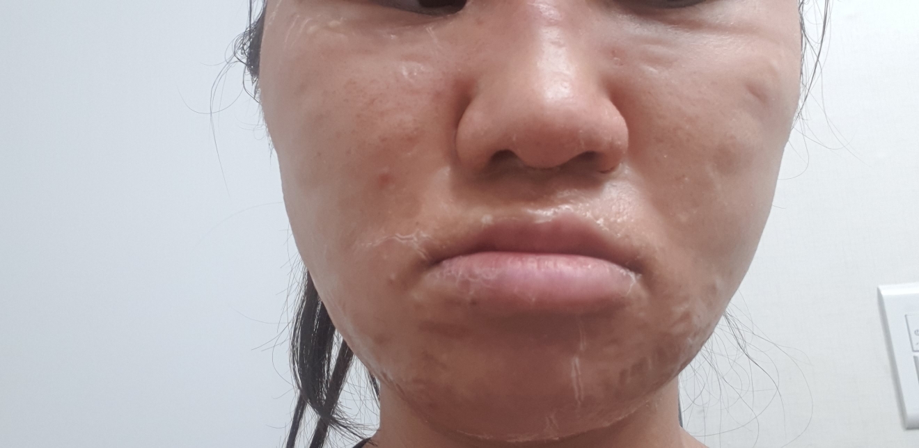 좀비뷰티 (ZOMBIEBEAUTY) 좀비팩 review image