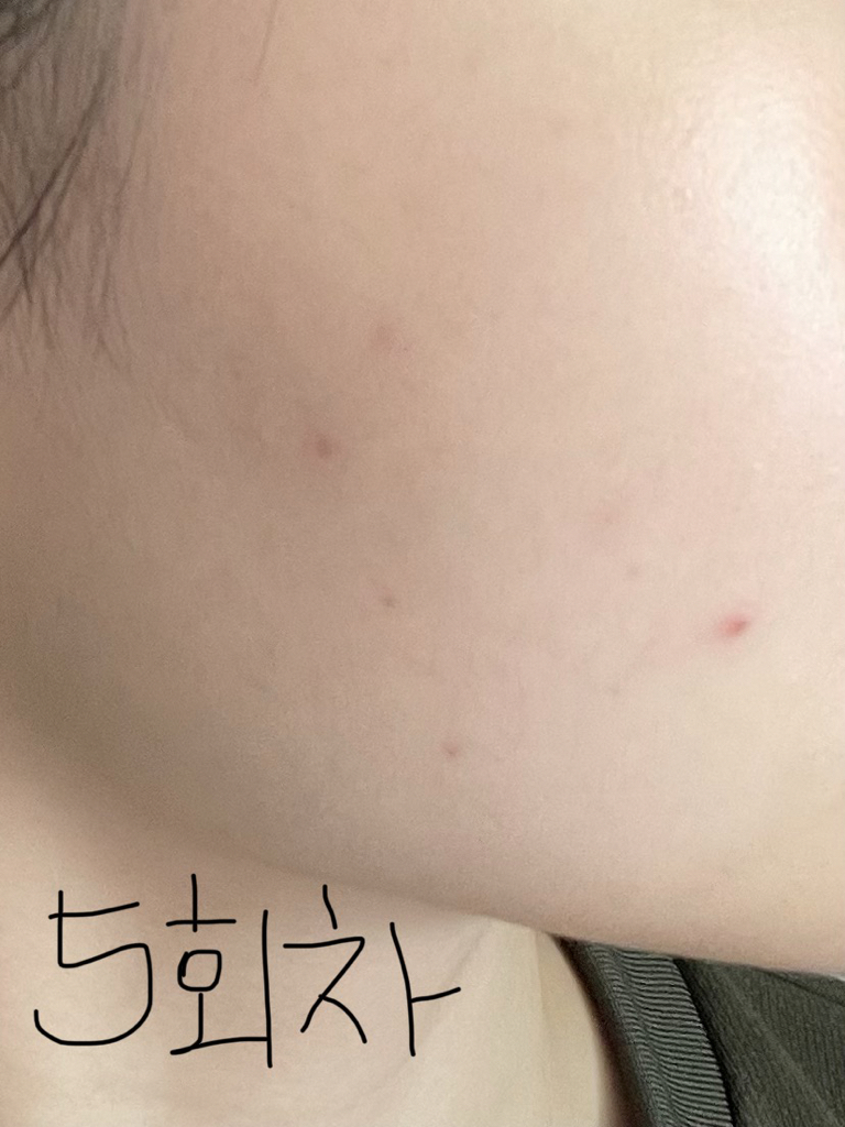 타포미 (TAFOMI) 카밍 탐 시트 마스크 review image