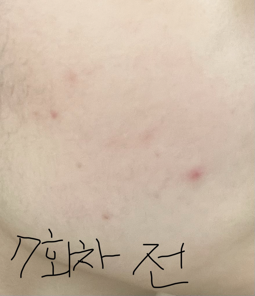 타포미 (TAFOMI) 카밍 탐 시트 마스크 review image