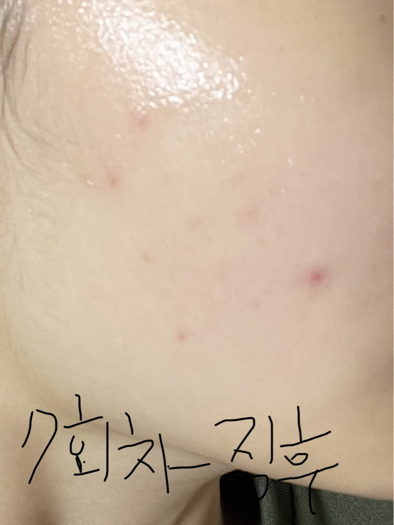 타포미 (TAFOMI) 카밍 탐 시트 마스크 review image