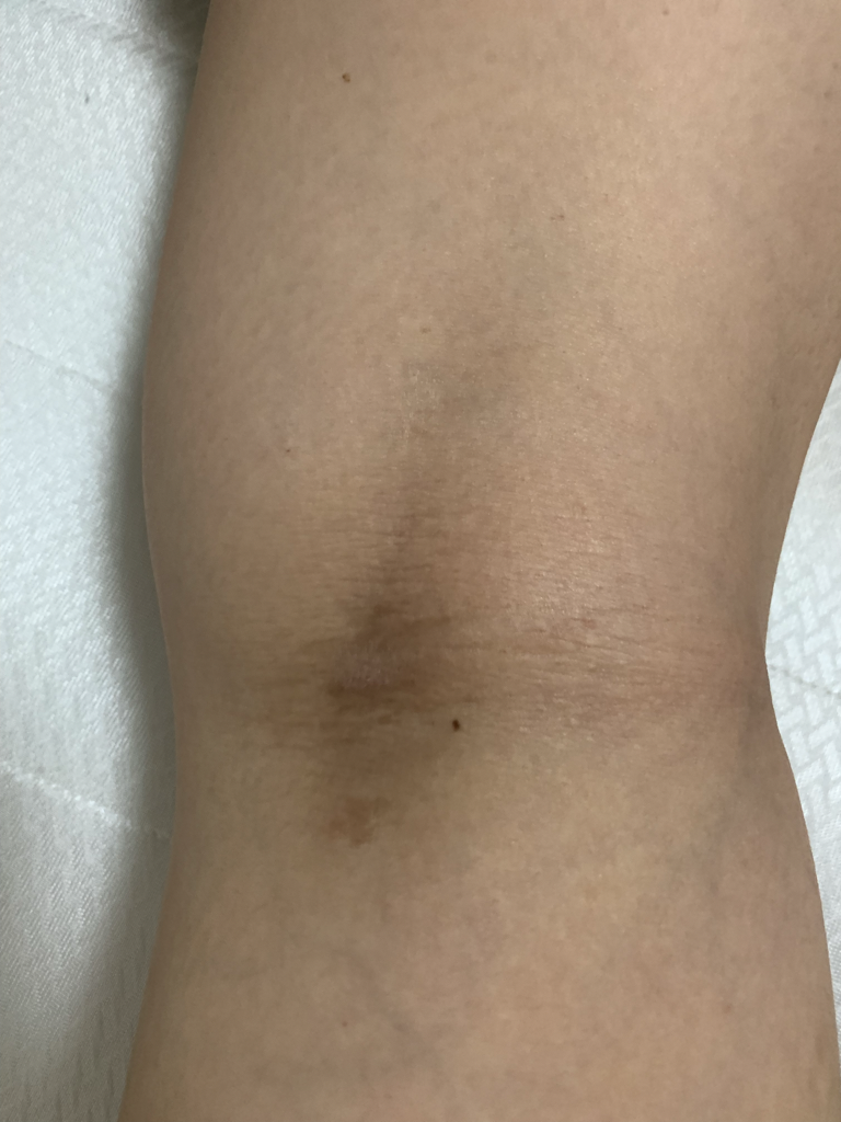 乳膏的真实用户使用照片