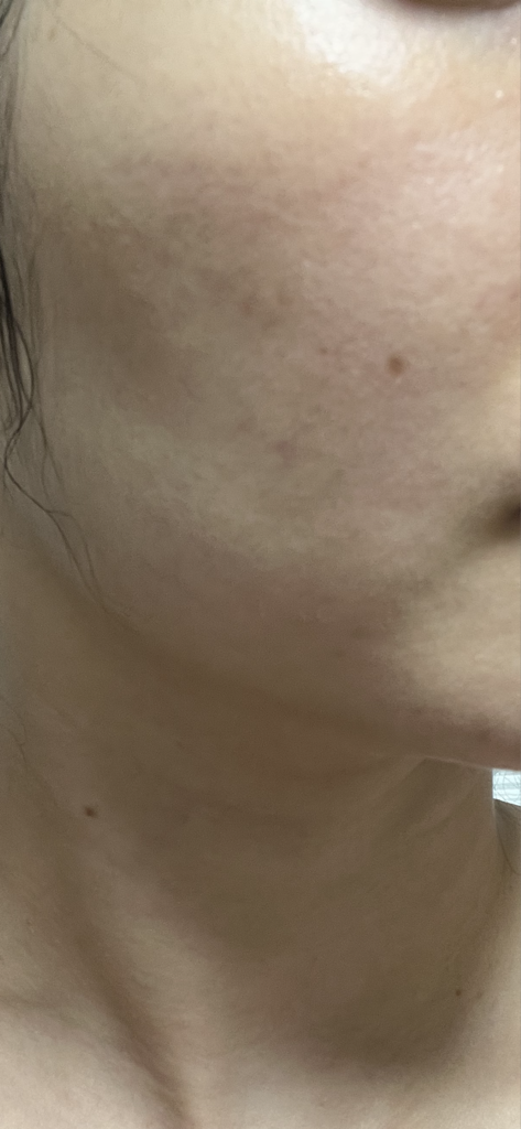 Exforin 10000 片装面膜的真实用户使用照片