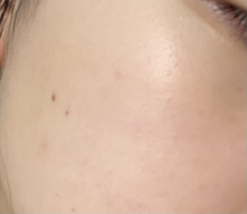 乳膏的真实用户使用照片