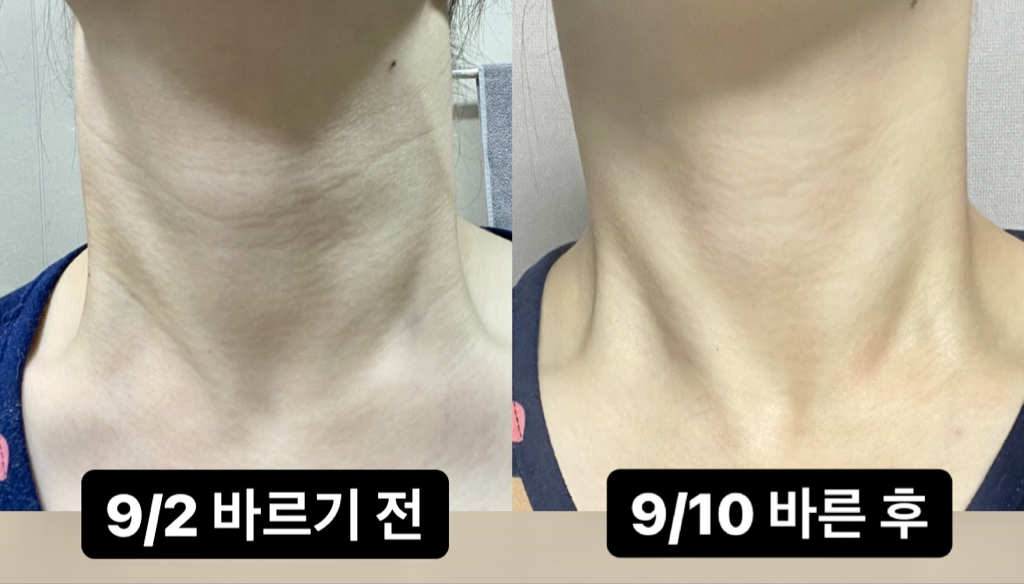 낫포유 (NOT4U) 목주름 세럼 review image