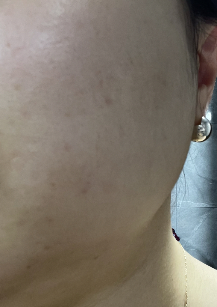 원씽 HOUTTUYNIA CORDATA EXTRACT review image