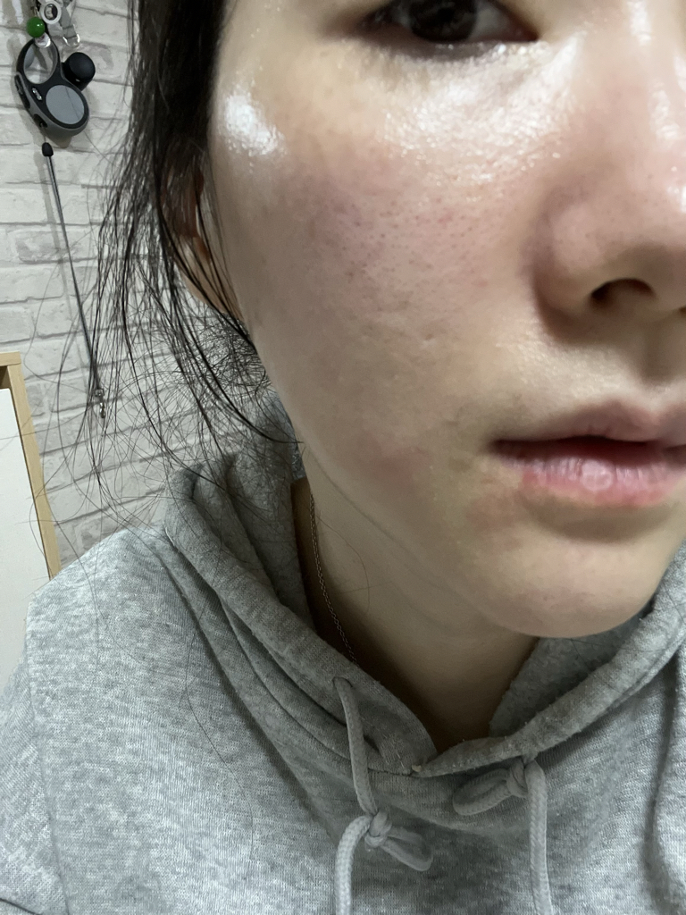 水解角质安瓶的真实用户使用照片