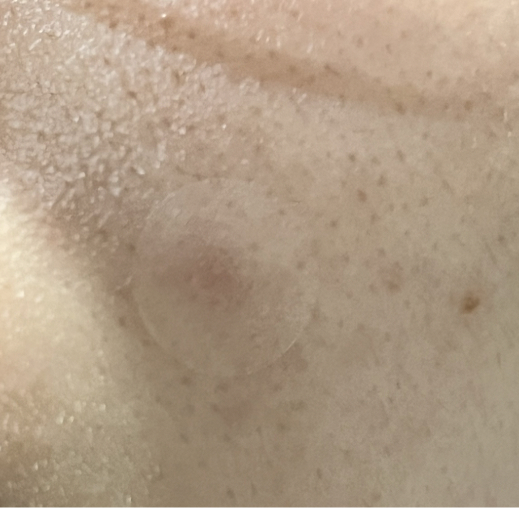 斑点修复膏的真实用户使用照片