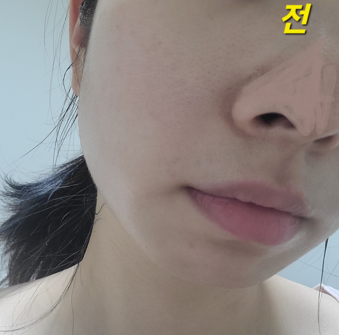프롬리에 (fromrier) 비건 어성초 히알 카밍 배리어 앰플 review image