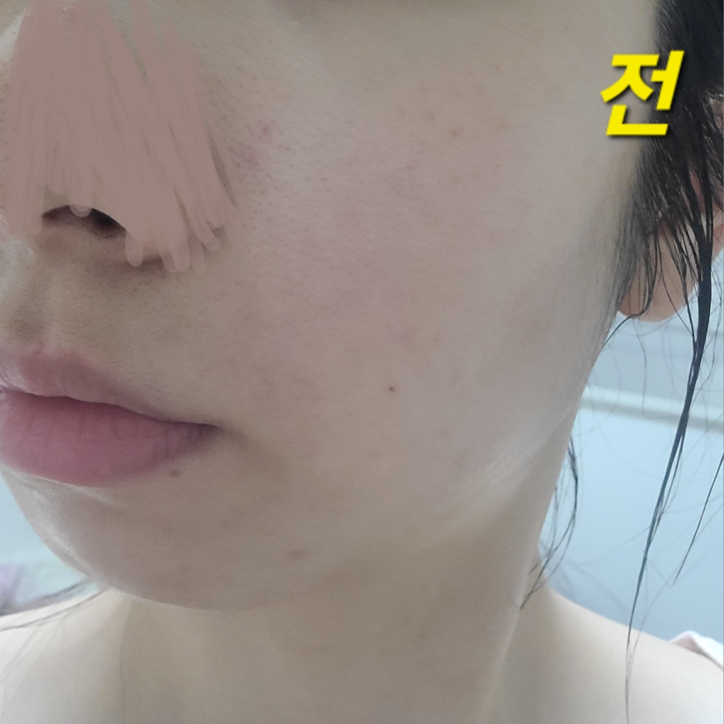 프롬리에 (fromrier) 비건 어성초 히알 카밍 배리어 앰플 review image